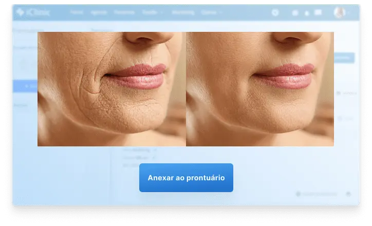 Comparação de imagens de antes e depois no prontuário do Afya iClinic — dados fictícios para demonstração